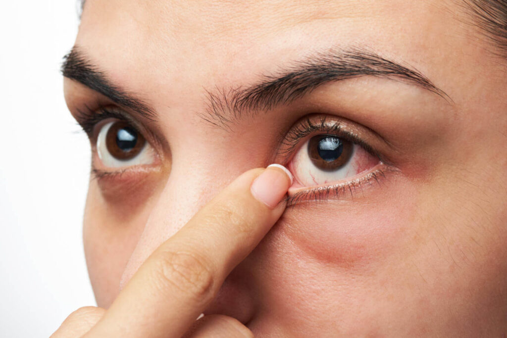 Lasik Refractive Surgeon in pune