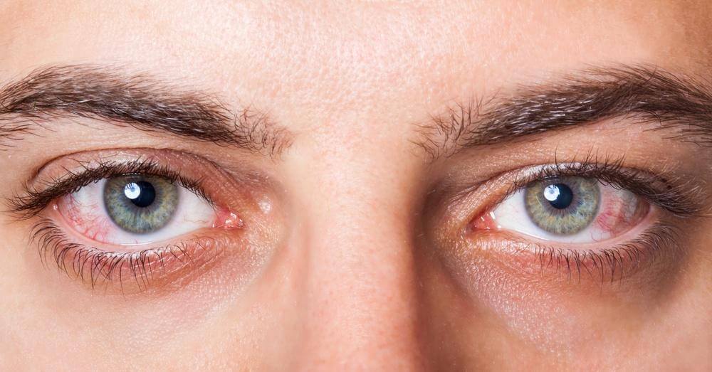 best glaucoma Treatment in pune