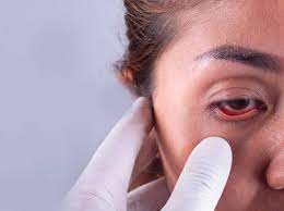 Diabetic Eye Screening in Pune