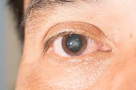 eye specialist in pune